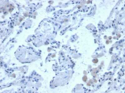 Immunohistochemistry-Paraffin: Cystatin B/Stefin B Antibody (CPTC-CSTB-3) [NBP3-07788]
