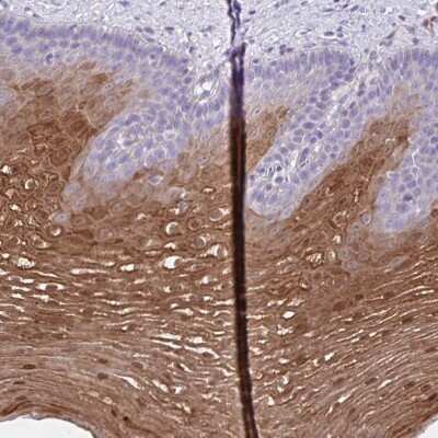 Immunohistochemistry-Paraffin: Cystatin B/Stefin B Antibody [NBP2-49285]