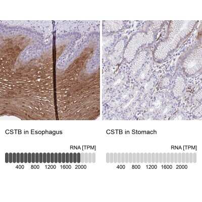 Immunohistochemistry-Paraffin: Cystatin B/Stefin B Antibody [NBP2-49285]