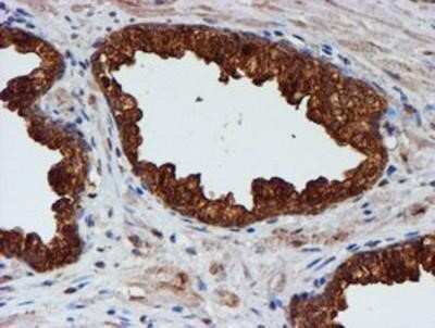 Immunohistochemistry: Cystatin C Antibody (OTI2C8) - Azide and BSA Free [NBP2-70472]