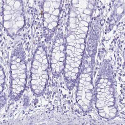 Immunohistochemistry-Paraffin: Cystatin D/Cst5 Antibody [NBP2-31852]