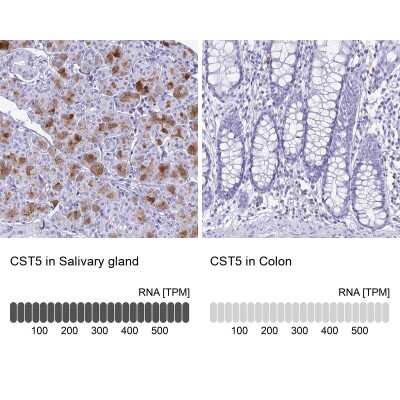 Immunohistochemistry-Paraffin: Cystatin D/Cst5 Antibody [NBP2-31852]