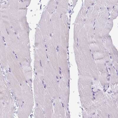 Immunohistochemistry-Paraffin: Cystatin E/M/CST6 Antibody [NBP2-33433]