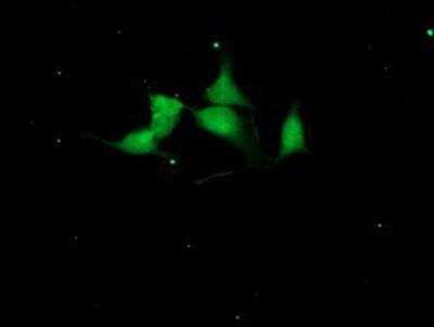 Immunocytochemistry/ Immunofluorescence: Cystatin S Antibody (OTI2H10) [NBP2-01656]
