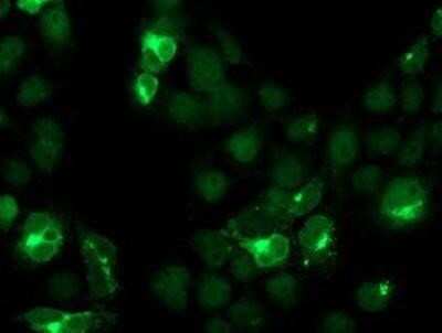 Immunocytochemistry/ Immunofluorescence: Cystatin S Antibody (OTI2H10) - Azide and BSA Free [NBP2-70481]