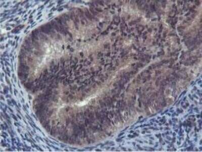Immunohistochemistry: Cystatin SA Antibody (OTI1D6) - Azide and BSA Free [NBP2-70466]