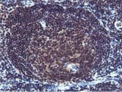Immunohistochemistry: Cystatin SA Antibody (OTI1D6) - Azide and BSA Free [NBP2-70466]
