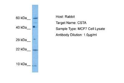 Western Blot: Cystatin A Antibody [NBP2-86611]