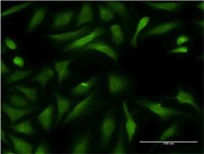 Immunocytochemistry/ Immunofluorescence: Cysteine Conjugate beta-Lyase/CCBL1 Antibody (1B12) [H00000883-M02]