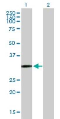 Western Blot: Cysteine Dioxygenase Type 1 Antibody [H00001036-B01P]
