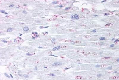 Immunohistochemistry-Paraffin: Cysteinyl Leukotriene R2/CysLTR2 Antibody [NBP3-14292]