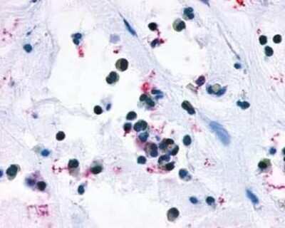 Immunohistochemistry-Paraffin: Cysteinyl Leukotriene R1/CysLTR1 Antibody - BSA Free [NLS1317]
