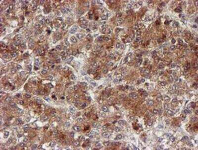 Immunohistochemistry-Paraffin: Cytochrome P450 17A1 Antibody (OTI3F11) [NBP2-01151]