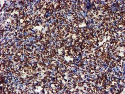 Immunohistochemistry-Paraffin: Cytochrome P450 17A1 Antibody (OTI3F11) [NBP2-01151]