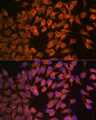 Immunocytochemistry/ Immunofluorescence: Cytochrome P450 17A1 Antibody (5D2H1) [NBP3-16541]