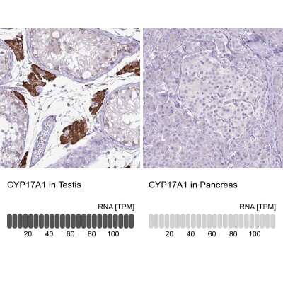 Immunohistochemistry-Paraffin: Cytochrome P450 17A1 Antibody [NBP2-13892]