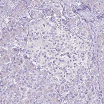 Immunohistochemistry-Paraffin: Cytochrome P450 17A1 Antibody [NBP2-13892]