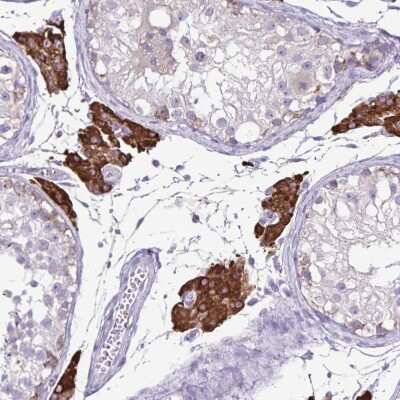 Immunohistochemistry-Paraffin: Cytochrome P450 17A1 Antibody [NBP2-13892]