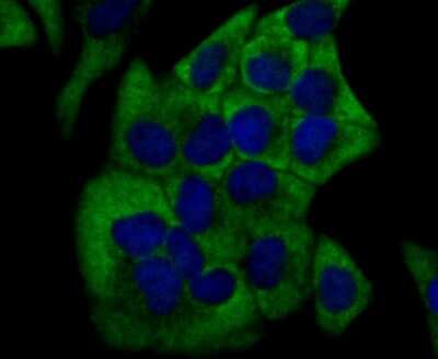 Immunocytochemistry/ Immunofluorescence: Cytochrome P450 17A1 Antibody (JB93-32) [NBP2-75461]