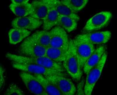Immunocytochemistry/ Immunofluorescence: Cytochrome P450 17A1 Antibody (JB93-32) [NBP2-75461]