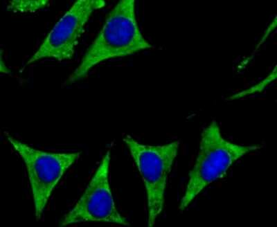 Immunocytochemistry/ Immunofluorescence: Cytochrome P450 17A1 Antibody (JB93-32) [NBP2-75461]