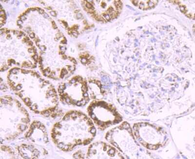 Immunohistochemistry-Paraffin: Cytochrome P450 17A1 Antibody (JB93-32) [NBP2-75461]