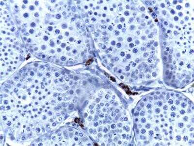 Immunohistochemistry: Cytochrome P450 17A1 Antibody (OTI3F11) - Azide and BSA Free [NBP2-70544]