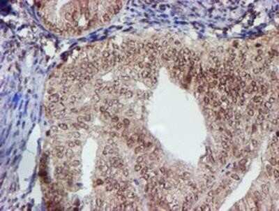 Immunohistochemistry: Cytochrome P450 17A1 Antibody (OTI3F11) - Azide and BSA Free [NBP2-70544]