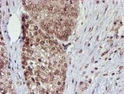 Immunohistochemistry: Cytochrome P450 17A1 Antibody (OTI3F11) - Azide and BSA Free [NBP2-70544]