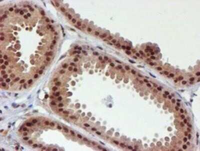 Immunohistochemistry: Cytochrome P450 17A1 Antibody (OTI3F11) - Azide and BSA Free [NBP2-70544]