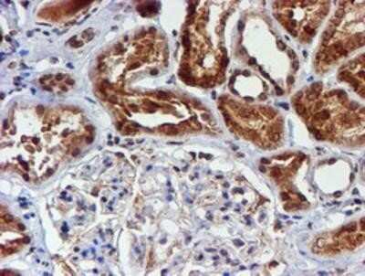 Immunohistochemistry: Cytochrome P450 17A1 Antibody (OTI3F11) - Azide and BSA Free [NBP2-70544]