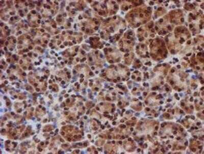 Immunohistochemistry: Cytochrome P450 17A1 Antibody (OTI3F11) - Azide and BSA Free [NBP2-70544]