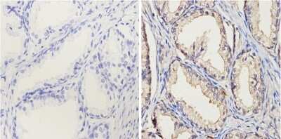 Immunohistochemistry-Paraffin: Cytochrome P450 1A1/1A2 Antibody (MC1) [NB100-74398]