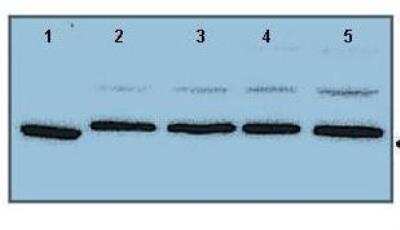 Western Blot: Cytochrome P450 1A1 Antibody [NBP1-62405]