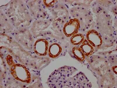 Immunohistochemistry: Cytochrome P450 1A2 Antibody (8B2) [NBP3-15169]