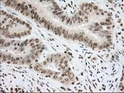 Immunohistochemistry: Cytochrome P450 1A2 Antibody (OTI8F1) - Azide and BSA Free [NBP2-70518]