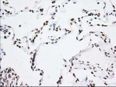 Immunohistochemistry: Cytochrome P450 1A2 Antibody (OTI8F1) - Azide and BSA Free [NBP2-70518]
