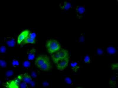Immunocytochemistry/ Immunofluorescence: Cytochrome P450 1A2 Antibody (OTI8F1) [NBP2-02563]