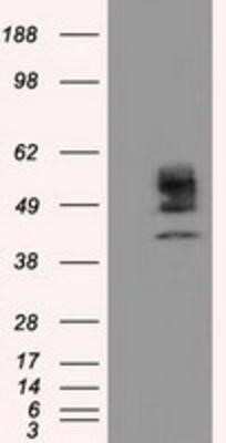 Western Blot: Cytochrome P450 1A2 Antibody (OTI8F1) [NBP2-02563]