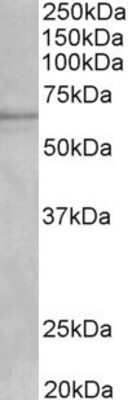 Western Blot: Cytochrome P450 1A2 Antibody [NBP1-97780]
