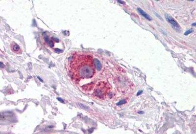 Immunohistochemistry-Paraffin: Cytochrome P450 26B1 Antibody [NB100-53810]