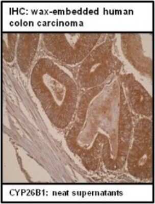Immunohistochemistry-Paraffin: Cytochrome P450 26B1 Antibody (T5P3G2*A3) - BSA Free [NBP2-50195]