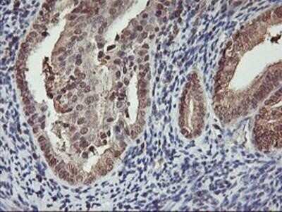 Immunohistochemistry: Cytochrome P450 2A6 Antibody (OTI1D2) - Azide and BSA Free [NBP2-70524]