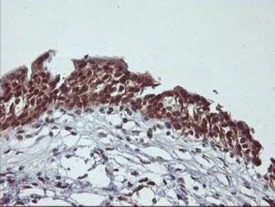 Immunohistochemistry: Cytochrome P450 2A6 Antibody (OTI1D2) - Azide and BSA Free [NBP2-70524]