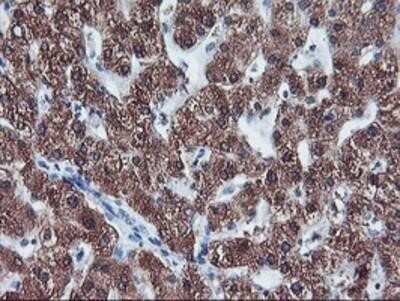 Immunohistochemistry: Cytochrome P450 2A6 Antibody (OTI1D2) - Azide and BSA Free [NBP2-70524]
