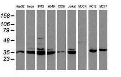 Western Blot: Cytochrome P450 2A6 Antibody (OTI1D2)Azide and BSA Free [NBP2-70524]