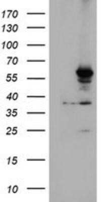 Western Blot: Cytochrome P450 2A6 Antibody (OTI1D2) [NBP2-01437]