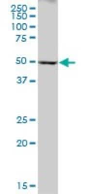 Western Blot: Cytochrome P450 2A6 Antibody [H00001548-B01P]