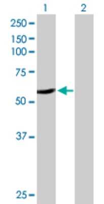 Western Blot: Cytochrome P450 2A6 Antibody [H00001548-D01P]