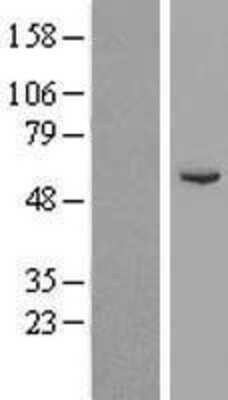 Western Blot: Cytochrome P450 2A6 Overexpression Lysate [NBP2-10708]